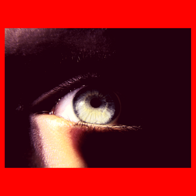 photo eyes red